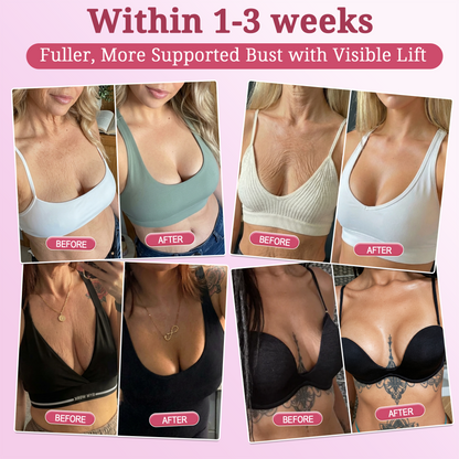 🇨🇦2𝐇𝐈𝐒𝐊𝐈𝐍® 𝐏𝐃𝐑𝐍 𝐏𝐢𝐧𝐤 𝐂𝐨𝐥𝐥𝐚𝐠𝐞𝐧 𝐒𝐭𝐞𝐦𝐋𝐢𝐟𝐭 𝐏𝐥𝐮𝐦𝐩𝐢𝐧𝐠 𝐌𝐮𝐥𝐭𝐢 𝐁𝐚𝐥𝐦 𝐟𝐨𝐫 𝐔𝐧𝐝𝐞𝐫-𝐄𝐲𝐞𝐬, 𝐍𝐞𝐜𝐤, 𝐅𝐨𝐫𝐞𝐡𝐞𝐚𝐝, 𝐒𝐦𝐢𝐥𝐞 𝐋𝐢𝐧𝐞𝐬,𝐅𝐢𝐫𝐦𝐢𝐧𝐠, 𝐋𝐢𝐟𝐭𝐢𝐧𝐠, 𝐅𝐮𝐥𝐥𝐞𝐫-𝐋𝐨𝐨𝐤𝐢𝐧𝐠 𝐂𝐮𝐫𝐯𝐞𝐬 & 𝐒𝐤𝐢𝐧 𝐂𝐨𝐦𝐟𝐨𝐫𝐭