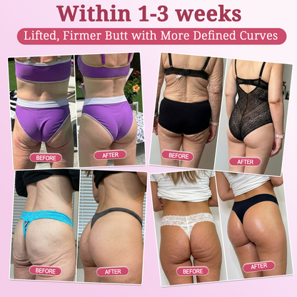 🇨🇦2𝐇𝐈𝐒𝐊𝐈𝐍® 𝐏𝐃𝐑𝐍 𝐏𝐢𝐧𝐤 𝐂𝐨𝐥𝐥𝐚𝐠𝐞𝐧 𝐒𝐭𝐞𝐦𝐋𝐢𝐟𝐭 𝐏𝐥𝐮𝐦𝐩𝐢𝐧𝐠 𝐌𝐮𝐥𝐭𝐢 𝐁𝐚𝐥𝐦 𝐟𝐨𝐫 𝐔𝐧𝐝𝐞𝐫-𝐄𝐲𝐞𝐬, 𝐍𝐞𝐜𝐤, 𝐅𝐨𝐫𝐞𝐡𝐞𝐚𝐝, 𝐒𝐦𝐢𝐥𝐞 𝐋𝐢𝐧𝐞𝐬,𝐅𝐢𝐫𝐦𝐢𝐧𝐠, 𝐋𝐢𝐟𝐭𝐢𝐧𝐠, 𝐅𝐮𝐥𝐥𝐞𝐫-𝐋𝐨𝐨𝐤𝐢𝐧𝐠 𝐂𝐮𝐫𝐯𝐞𝐬 & 𝐒𝐤𝐢𝐧 𝐂𝐨𝐦𝐟𝐨𝐫𝐭