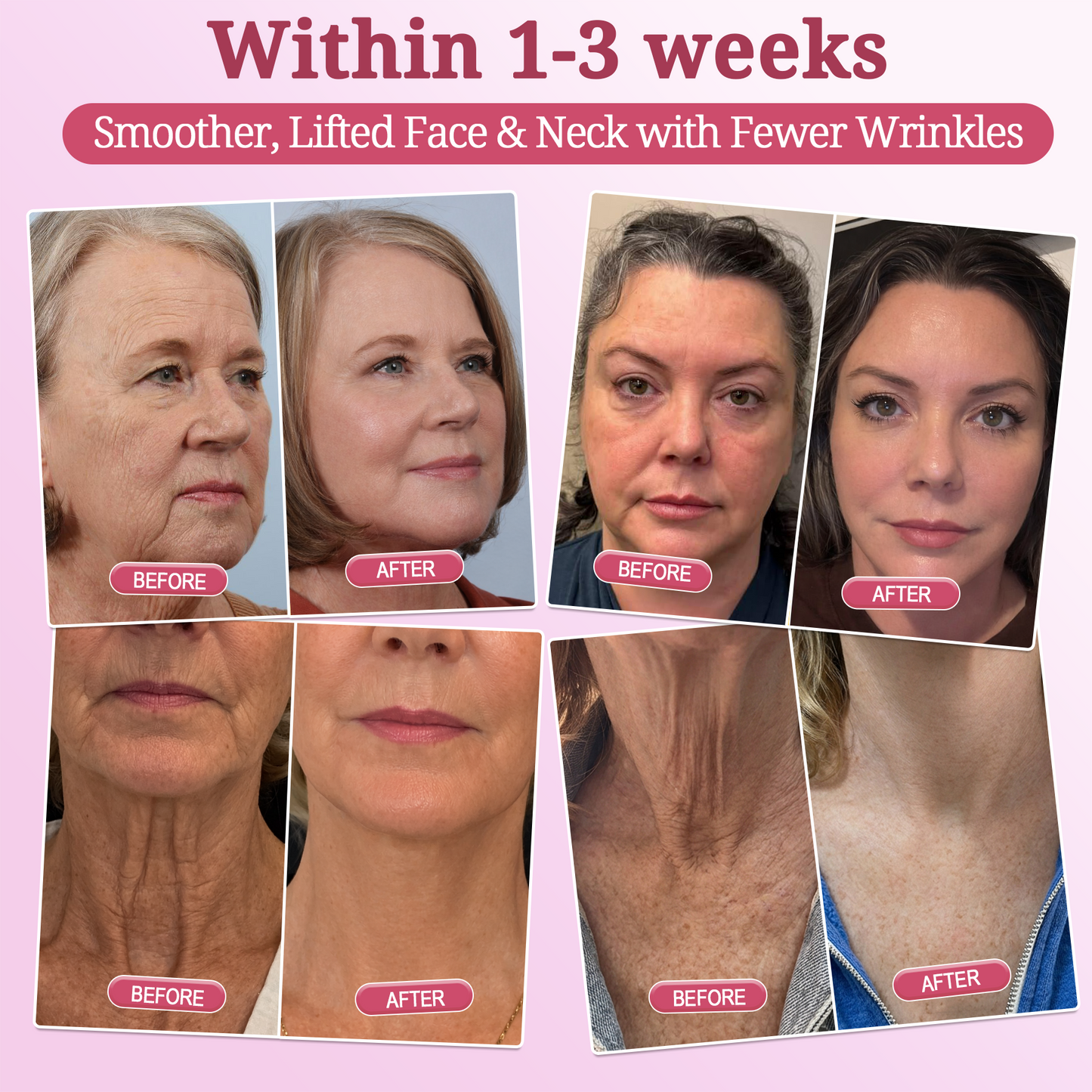 🇨🇦2𝐇𝐈𝐒𝐊𝐈𝐍® 𝐏𝐃𝐑𝐍 𝐏𝐢𝐧𝐤 𝐂𝐨𝐥𝐥𝐚𝐠𝐞𝐧 𝐒𝐭𝐞𝐦𝐋𝐢𝐟𝐭 𝐏𝐥𝐮𝐦𝐩𝐢𝐧𝐠 𝐌𝐮𝐥𝐭𝐢 𝐁𝐚𝐥𝐦 𝐟𝐨𝐫 𝐔𝐧𝐝𝐞𝐫-𝐄𝐲𝐞𝐬, 𝐍𝐞𝐜𝐤, 𝐅𝐨𝐫𝐞𝐡𝐞𝐚𝐝, 𝐒𝐦𝐢𝐥𝐞 𝐋𝐢𝐧𝐞𝐬,𝐅𝐢𝐫𝐦𝐢𝐧𝐠, 𝐋𝐢𝐟𝐭𝐢𝐧𝐠, 𝐅𝐮𝐥𝐥𝐞𝐫-𝐋𝐨𝐨𝐤𝐢𝐧𝐠 𝐂𝐮𝐫𝐯𝐞𝐬 & 𝐒𝐤𝐢𝐧 𝐂𝐨𝐦𝐟𝐨𝐫𝐭