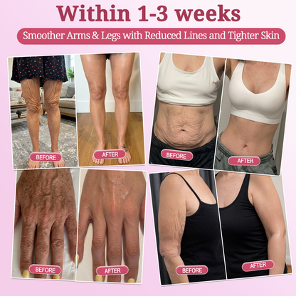 🇨🇦2𝐇𝐈𝐒𝐊𝐈𝐍® 𝐏𝐃𝐑𝐍 𝐏𝐢𝐧𝐤 𝐂𝐨𝐥𝐥𝐚𝐠𝐞𝐧 𝐒𝐭𝐞𝐦𝐋𝐢𝐟𝐭 𝐏𝐥𝐮𝐦𝐩𝐢𝐧𝐠 𝐌𝐮𝐥𝐭𝐢 𝐁𝐚𝐥𝐦 𝐟𝐨𝐫 𝐔𝐧𝐝𝐞𝐫-𝐄𝐲𝐞𝐬, 𝐍𝐞𝐜𝐤, 𝐅𝐨𝐫𝐞𝐡𝐞𝐚𝐝, 𝐒𝐦𝐢𝐥𝐞 𝐋𝐢𝐧𝐞𝐬,𝐅𝐢𝐫𝐦𝐢𝐧𝐠, 𝐋𝐢𝐟𝐭𝐢𝐧𝐠, 𝐅𝐮𝐥𝐥𝐞𝐫-𝐋𝐨𝐨𝐤𝐢𝐧𝐠 𝐂𝐮𝐫𝐯𝐞𝐬 & 𝐒𝐤𝐢𝐧 𝐂𝐨𝐦𝐟𝐨𝐫𝐭