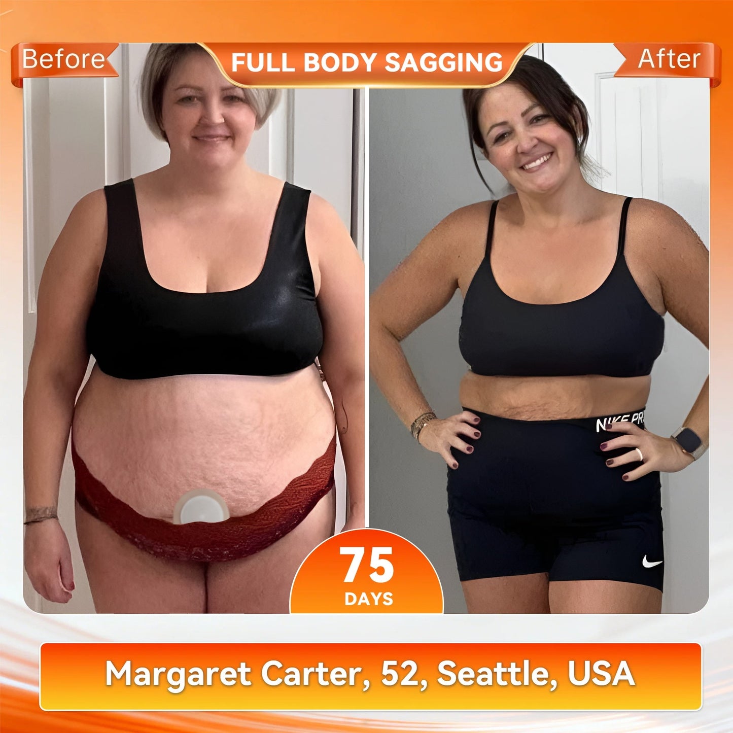 𝟐𝟓𝟎𝐭𝐡 𝐀𝐧𝐧𝐢𝐯𝐞𝐫𝐬𝐚𝐫𝐲 𝐄𝐱𝐜𝐥𝐮𝐬𝐢𝐯𝐞🗽𝑨𝑴𝒁𝑲𝑬𝑬𝑷® 𝑵𝑨𝑫+ 𝑴𝒐𝒓𝒊𝒏𝒈𝒂 𝑩𝒆𝒓𝒃𝒆𝒓𝒊𝒏𝒆 𝑵𝒂𝒏𝒐 𝑴𝒊𝒄𝒓𝒐𝒏𝒆𝒆𝒅𝒍𝒆 𝑷𝒂𝒕𝒄𝒉 𝐉𝐮𝐬𝐭 𝐨𝐧𝐜𝐞 𝐚 𝐝𝐚𝐲, 𝐯𝐢𝐬𝐢𝐛𝐥𝐞 𝐜𝐡𝐚𝐧𝐠𝐞𝐬 𝐢𝐧 𝟕 𝐝𝐚𝐲𝐬 𝙁𝙤𝙧𝙢𝙪𝙡𝙖 ✅ 𝐅𝐨𝐫 𝑺𝒖𝒑𝒑𝒐𝒓𝒕𝒔 𝑴𝒆𝒕𝒂𝒃𝒐𝒍𝒊𝒔𝒎, 𝑾𝒆𝒊𝒈𝒉𝒕 𝑴𝒂𝒏𝒂𝒈𝒆𝒎𝒆𝒏𝒕, 𝑯𝒆𝒂𝒓𝒕 𝑯𝒆𝒂𝒍𝒕𝒉, O𝐛𝐞𝐬𝐢𝐭𝐲, 𝗟𝗼𝗼𝘀𝗲 S𝗸𝗶𝗻, D𝐢𝐚𝐛𝐞𝐭𝐞𝐬, S𝐥𝐞𝐞𝐩 A𝐩𝐧𝐞𝐚, J𝐨𝐢𝐧𝐭 I𝐬𝐬𝐮𝐞𝐬